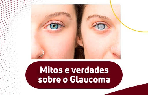 Mitos e Verdades sobre o Glaucoma